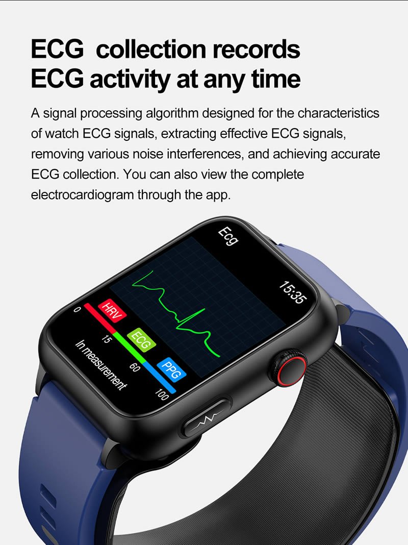 ECG Monitor Watch